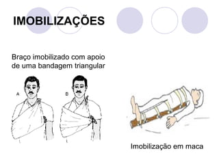 IMOBILIZAÇÕES

Braço imobilizado com apoio
de uma bandagem triangular




                              Imobilização em maca
 