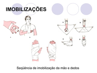 IMOBILIZAÇÕES




   Seqüência de imobilização da mão e dedos
 