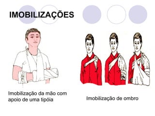 IMOBILIZAÇÕES




Imobilização da mão com
apoio de uma tipóia       Imobilização de ombro
 