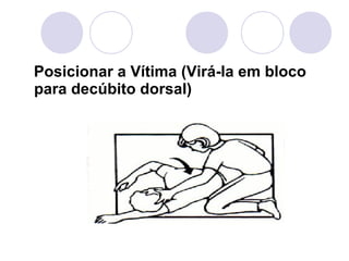 Posicionar a Vítima (Virá-la em bloco
para decúbito dorsal)
 