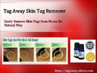 Tag Away Skin Tag Remover
Easily Remove Skin Tags from Home the
Natural Way




                                http://tagaway.sitew.com
 