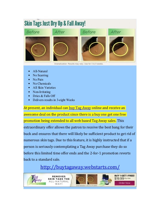 Tag Away Skin Tag Remover