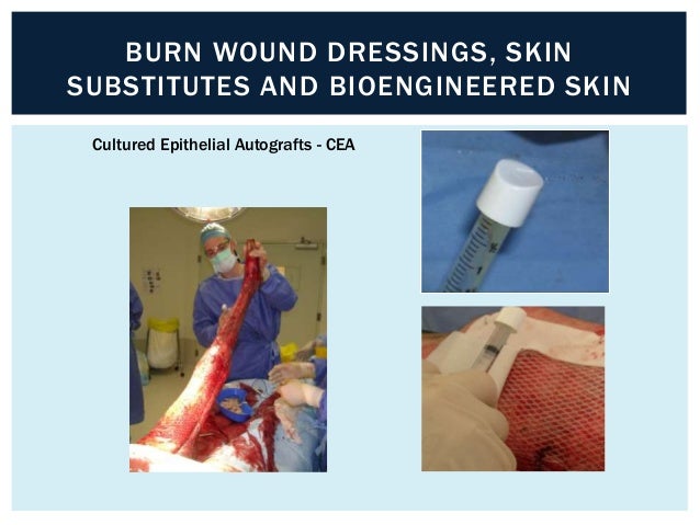 a paracetamol 8 day uncovered on 2 covered burns Taggart then