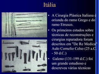 Itália
• A Cirurgia Plástica Italiana é
oriunda do ramo Grego e do
ramo Etrusco.
• Os primeiros estudos sobre
técnicas de reconstruções e
cirurgias reparadora foram
descritos em "De Re Medica"
Aulo Cornelio Celso (25 a.C.
- 50 d.C.)
• Galeno (131-199 d.C.) foi
um grande estudioso e
descreveu várias técnicas
 