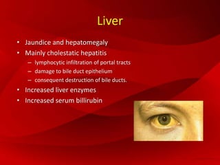 Liver
• Jaundice and hepatomegaly
• Mainly cholestatic hepatitis
– lymphocytic infiltration of portal tracts
– damage to bile duct epithelium
– consequent destruction of bile ducts.
• Increased liver enzymes
• Increased serum billirubin
 