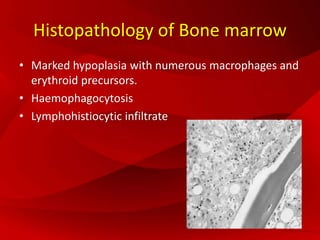 Histopathology of Bone marrow
• Marked hypoplasia with numerous macrophages and
erythroid precursors.
• Haemophagocytosis
• Lymphohistiocytic infiltrate
 