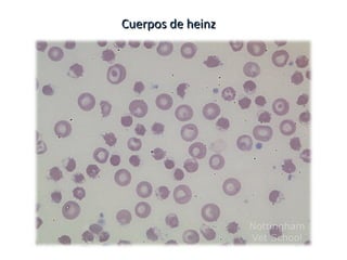 Cuerpos de heinzCuerpos de heinz
 