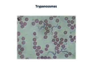TrypanosomasTrypanosomas
 