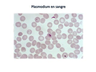 Plasmodium en sangrePlasmodium en sangre
 