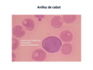 Anillos de cabotAnillos de cabot
 