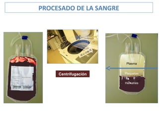 Centrifugación
Plasma
Hematíes
Plaquetas
PROCESADO DE LA SANGRE
 