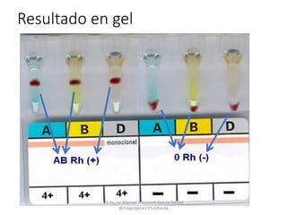 Resultado en gel
CC by_nc Manuel Francisco García Gálvez
@magargalvez ES Albaida
 