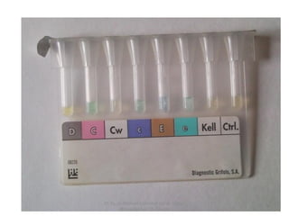 CC by_nc Manuel Francisco García Gálvez
@magargalvez ES Albaida
 