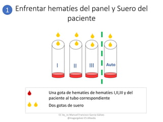 I


II III Auto







 
Una gota de hematíes de hematíes I,II,III y del
paciente al tubo correspondiente
Dos gotas de suero
1 Enfrentar hematíes del panel y Suero del
paciente
CC by_nc Manuel Francisco García Gálvez
@magargalvez ES Albaida
 
