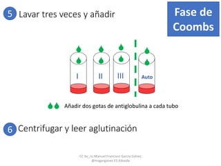 5 Lavar tres veces y añadir
I II Auto
Fase de
Coombs
III








Añadir dos gotas de antiglobulina a cada tubo
6 Centrifugar y leer aglutinación
CC by_nc Manuel Francisco García Gálvez
@magargalvez ES Albaida
 