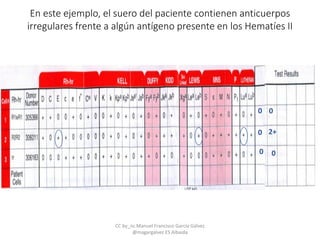 0
0
0
0
0
2+
En este ejemplo, el suero del paciente contienen anticuerpos
irregulares frente a algún antígeno presente en los Hematíes II
CC by_nc Manuel Francisco García Gálvez
@magargalvez ES Albaida
 