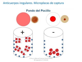 Anticuerpos iregulares. Microplacas de captura
CC by_nc Manuel Francisco García Gálvez
@magargalvez ES Albaida
 