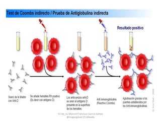 CC by_nc Manuel Francisco García Gálvez
@magargalvez ES Albaida
 