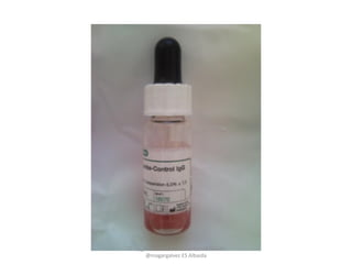 CC by_nc Manuel Francisco García Gálvez
@magargalvez ES Albaida
 