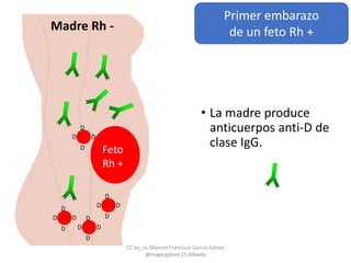• La madre produce
anticuerpos anti-D de
clase IgG.
D
DD
D
D
DD
D
D
DD
D
D
DD
D
D
DD
D
Primer embarazo
de un feto Rh +
Feto
Rh +
Madre Rh -
CC by_nc Manuel Francisco García Gálvez
@magargalvez ES Albaida
 