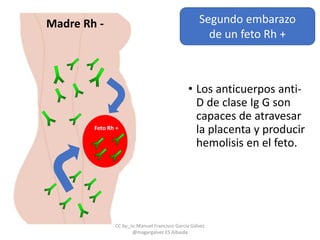 Madre Rh -
• Los anticuerpos anti-
D de clase Ig G son
capaces de atravesar
la placenta y producir
hemolisis en el feto.
Feto Rh +
Segundo embarazo
de un feto Rh +
CC by_nc Manuel Francisco García Gálvez
@magargalvez ES Albaida
 