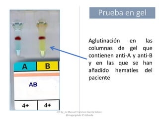 Aglutinación en las
columnas de gel que
contienen anti-A y anti-B
y en las que se han
añadido hematíes del
paciente
Prueba en gel
CC by_nc Manuel Francisco García Gálvez
@magargalvez ES Albaida
 