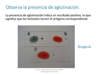 Observa la presencia de aglutinación.
 La presencia de aglutinación indica un resultado positivo, lo que
significa que los hematíes tienen el antígeno correspondiente
Grupo A-
+ -
-
CC by_nc Manuel Francisco García Gálvez
@magargalvez ES Albaida
 