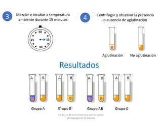 3 Mezclar e incubar a temperatura
ambiente durante 15 minutos 4
Centrifugar y observar la presencia
o ausencia de aglutinación
Aglutinación No aglutinación
Resultados
CC by_nc Manuel Francisco García Gálvez
@magargalvez ES Albaida
 
