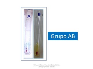 Grupo AB
CC by_nc Manuel Francisco García Gálvez
@magargalvez ES Albaida
 