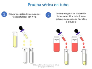 A B
1 Colocar dos gotas de suero en dos
tubos rotulados con A y B
A B
2
Colocar dos gotas de suspensión
de hematíes A1 al tubo A y dos
gotas de suspensión de hematíes
B al tubo B
Prueba sérica en tubo
CC by_nc Manuel Francisco García Gálvez
@magargalvez ES Albaida
 