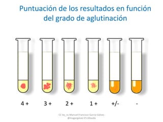 4 + 3 + 2 + 1 + +/- -
Puntuación de los resultados en función
del grado de aglutinación
CC by_nc Manuel Francisco García Gálvez
@magargalvez ES Albaida
 