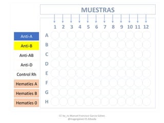 1 2 3 4 5 6 7 8 9 10 11 12
A
B
C
D
E
F
G
H
MUESTRAS
Anti-A
Anti-B
Anti-AB
Anti-D
Control Rh
Hematíes A
Hematíes B
Hematíes 0
CC by_nc Manuel Francisco García Gálvez
@magargalvez ES Albaida
 