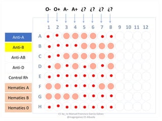 1 2 3 4 5 6 7 8 9 10 11 12
A
B
C
D
E
F
G
H
Anti-A
Anti-B
Anti-AB
Anti-D
Control Rh
Hematíes A
Hematíes B
Hematíes 0
O- O+ A- A+ ¿? ¿? ¿? ¿?
CC by_nc Manuel Francisco García Gálvez
@magargalvez ES Albaida
 