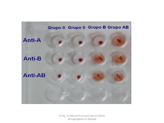 CC by_nc Manuel Francisco García Gálvez
@magargalvez ES Albaida
 