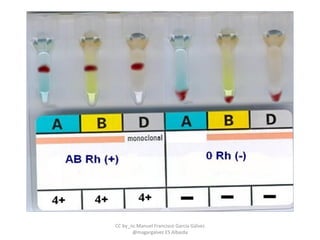 CC by_nc Manuel Francisco García Gálvez
@magargalvez ES Albaida
 