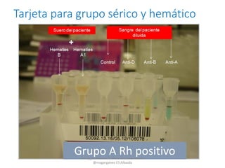 Tarjeta para grupo sérico y hemático
Grupo A Rh positivoCC by_nc Manuel Francisco García Gálvez
@magargalvez ES Albaida
 