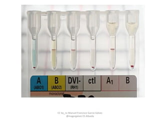 CC by_nc Manuel Francisco García Gálvez
@magargalvez ES Albaida
 