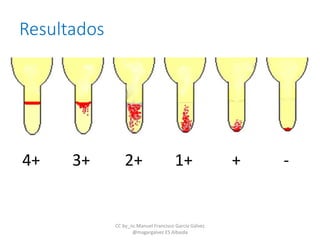 4+ 3+ 2+ 1+ + -
Resultados
CC by_nc Manuel Francisco García Gálvez
@magargalvez ES Albaida
 