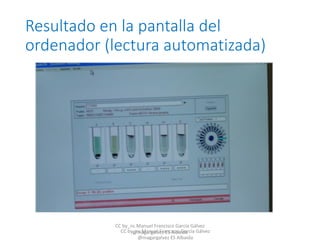 Resultado en la pantalla del
ordenador (lectura automatizada)
CC by_nc Manuel Francisco García Gálvez
@magargalvez ES AlbaidaCC by_nc Manuel Francisco García Gálvez
@magargalvez ES Albaida
 