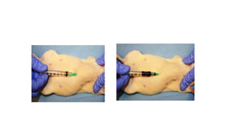 tail vein sampling.pptx clinical pharmacology | PPT
