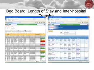 Bed Board: Length of Stay and Inter-hospital
Transfer
35
 
