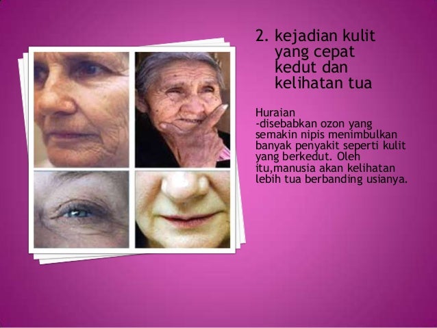Punca dan kesan rumah hijau, pemanasan global, dan