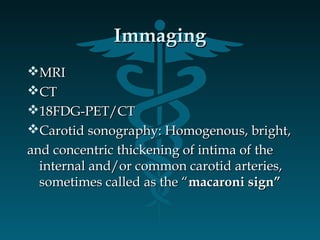 ImmagingImmaging
MRIMRI
CTCT
18FDG-PET/CT18FDG-PET/CT
Carotid sonography: Homogenous, bright,Carotid sonography: Homogenous, bright,
and concentric thickening of intima of theand concentric thickening of intima of the
internal and/or common carotid arteries,internal and/or common carotid arteries,
sometimes called as the “sometimes called as the “macaroni sign”macaroni sign”
 