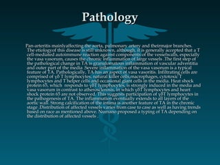 PathologyPathology
Pan-arteritis mainlyaffecting the aorta, pulmonary artery and theirmajor branches.Pan-arteritis mainlyaffecting the aorta, pulmonary artery and theirmajor branches.
The etiologyof this disease is still unknown, although, it is generally accepted that a TThe etiologyof this disease is still unknown, although, it is generally accepted that a T
cell-mediated autoimmune reaction against components of the vesselwalls, especiallycell-mediated autoimmune reaction against components of the vesselwalls, especially
the vasa vasorum, causes the chronic inflammation of large vessels .The first step ofthe vasa vasorum, causes the chronic inflammation of large vessels .The first step of
the pathological change in TA is granulomatous inflammation of vascular adventitiathe pathological change in TA is granulomatous inflammation of vascular adventitia
and outer part of the media .Severe inflammation of the vasa vasorum is a typicaland outer part of the media .Severe inflammation of the vasa vasorum is a typical
feature of TA. Pathologically, TA has an aspect of vasa vasoritis. Infiltrating cells arefeature of TA. Pathologically, TA has an aspect of vasa vasoritis. Infiltrating cells are
comprised of γδ T lymphocytes, natural killer cells,macrophages, cytotoxic Tcomprised of γδ T lymphocytes, natural killer cells,macrophages, cytotoxic T
lymphocytes and T helper cells and occasional giant cells in the media. Heat shocklymphocytes and T helper cells and occasional giant cells in the media. Heat shock
protein 65, which responds to γδT lymphocytes, is strongly induced in the media andprotein 65, which responds to γδT lymphocytes, is strongly induced in the media and
vasa vasorum in contrast to atherosclerosis, in which γδT lymphocytes and heartvasa vasorum in contrast to atherosclerosis, in which γδT lymphocytes and heart
shock protein 65 are not observed. This suggests participation of γδT lymphocytes inshock protein 65 are not observed. This suggests participation of γδT lymphocytes in
the pathogenesis of TA. The inflammation eventually extends to all layers of thethe pathogenesis of TA. The inflammation eventually extends to all layers of the
aortic wall. Strong calcification of the intima is another feature of TA in the chronicaortic wall. Strong calcification of the intima is another feature of TA in the chronic
stage .Distribution of affected vessels varies from case to case as well as having trendsstage .Distribution of affected vessels varies from case to case as well as having trends
based on race as mentioned above. Numano proposed a typing of TA depending onbased on race as mentioned above. Numano proposed a typing of TA depending on
the distribution of affected vessels .the distribution of affected vessels .
 