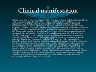 Clinical manifestationClinical manifestation
Clinical signs and symptoms originate from both the systemic inflammation and fromClinical signs and symptoms originate from both the systemic inflammation and from
local vascular complications. Serious complications such as visual loss, severelocal vascular complications. Serious complications such as visual loss, severe
hypertension, end-stage renal disease,and strokes are becoming less frequent,hypertension, end-stage renal disease,and strokes are becoming less frequent,
probably because of recent advances in imaging tests which allow relatively earlyprobably because of recent advances in imaging tests which allow relatively early
diagnosis. The most frequently observed systemic inflammatory symptoms are low ordiagnosis. The most frequently observed systemic inflammatory symptoms are low or
high grade fever, and general fatigue. These systemic symptoms could be insidioushigh grade fever, and general fatigue. These systemic symptoms could be insidious
and therefore be missed. Focal symptoms and signs are different depending on theand therefore be missed. Focal symptoms and signs are different depending on the
location of affected arteries. Pain in the upper body such as of the neck, jaw, arm,location of affected arteries. Pain in the upper body such as of the neck, jaw, arm,
shoulder,back, upper chest, and numbness of unilateral or both arms is a commonshoulder,back, upper chest, and numbness of unilateral or both arms is a common
complaint, since the aortic arch and its branches are the most commonly affectedcomplaint, since the aortic arch and its branches are the most commonly affected
lesions in this disease. Faintness or light headedness, especially upon gazinglesions in this disease. Faintness or light headedness, especially upon gazing
upwards, looking back, or using arms, is a frequently observed complaint. Lesions inupwards, looking back, or using arms, is a frequently observed complaint. Lesions in
the abdominal aorta cause hypertension, intermittent claudication, abdominal andthe abdominal aorta cause hypertension, intermittent claudication, abdominal and
low back pain.Physical examination is crucially important for being alerted to thelow back pain.Physical examination is crucially important for being alerted to the
presence of this disease. Pulselessness of unilateral or both radial arteries,andpresence of this disease. Pulselessness of unilateral or both radial arteries,and
vascular bruit are noticed in the neck, chest, back and abdomen.Visual as well asvascular bruit are noticed in the neck, chest, back and abdomen.Visual as well as
hearing disturbance are observed but can be temporal.Since the inflammatory lesionshearing disturbance are observed but can be temporal.Since the inflammatory lesions
usually extend longitudinally and are continuous in the aorta, we should be veryusually extend longitudinally and are continuous in the aorta, we should be very
careful to manage the whole aorta and its major branches even if there are nocareful to manage the whole aorta and its major branches even if there are no
apparent signs of arterial stenosis or dilationapparent signs of arterial stenosis or dilation
 