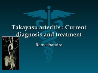 Takayasu arteritis : CurrentTakayasu arteritis : Current
diagnosis and treatmentdiagnosis and treatment
RamachandraRamachandra
 