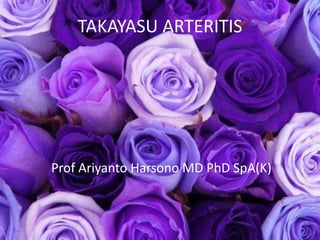 TAKAYASU ARTERITIS 
Prof Ariyanto Harsono MD PhD SpA(K) 
 