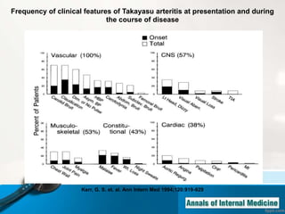 Kerr, G. S. et. al. Ann Intern Med 1994;120:919-929
Frequency of clinical features of Takayasu arteritis at presentation and during
the course of disease
 