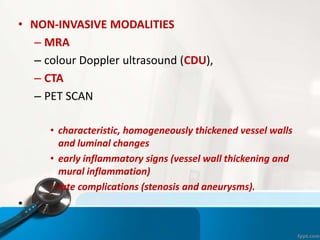 • NON-INVASIVE MODALITIES
– MRA
– colour Doppler ultrasound (CDU),
– CTA
– PET SCAN
• characteristic, homogeneously thickened vessel walls
and luminal changes
• early inflammatory signs (vessel wall thickening and
mural inflammation)
• late complications (stenosis and aneurysms).
•
 