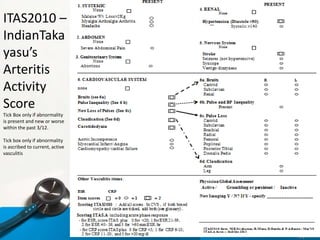 ITAS2010 –
IndianTaka
yasu’s
Arteritis
Activity
Score
Tick Box only if abnormality
is present and new or worse
within the past 3/12.
Tick box only if abnormality
is ascribed to current, active
vasculitis
 
